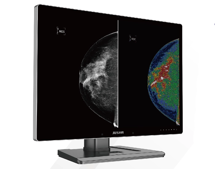 monitor Jusha C1210G mamografia